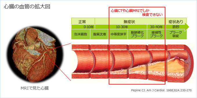 心臓の血管の拡大図